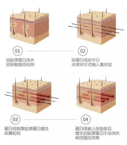 年轻or衰老，只在美莱一线之间